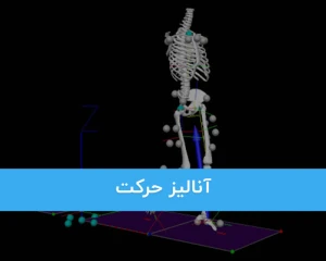 آنالیز حرکت چگونه می تواند برای تشخیص بهتر به پزشکان کمک کند ؟