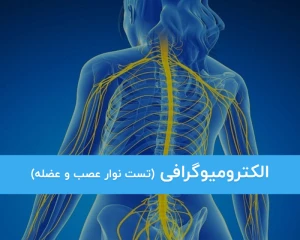 نوار عصب و عضله یا الکترومیوگرافی